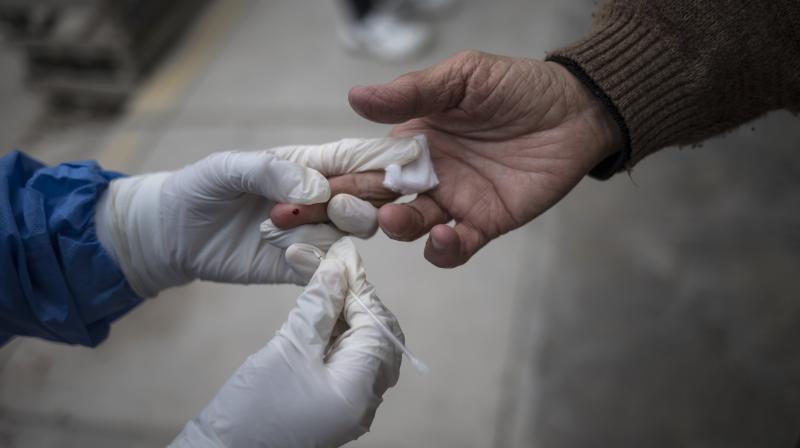 Study: People with O blood group have lower risk of infection from COVID-19