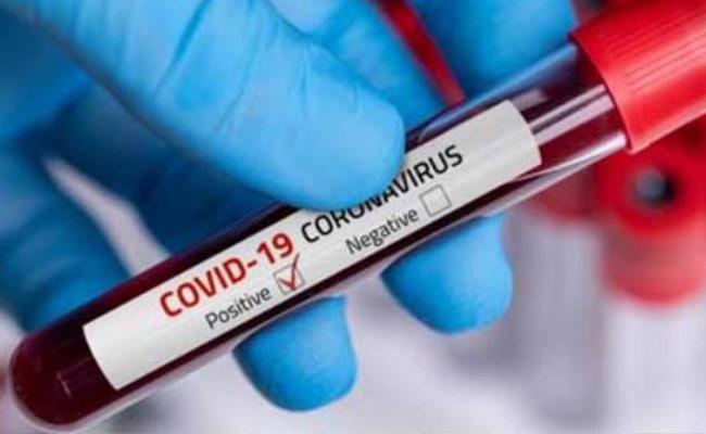 Andhra Pradesh crosses one crore Covid tests!