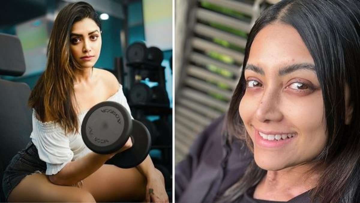 Another Heroine Suffers From An Auto-Immune Disease