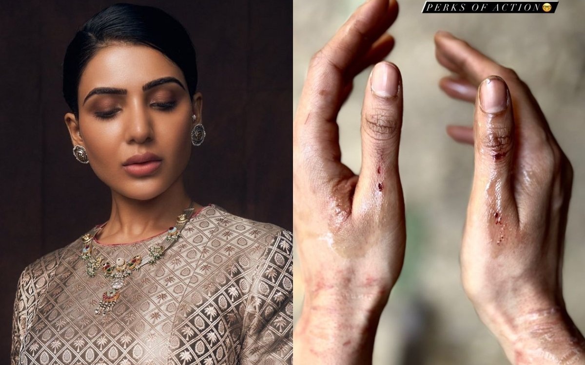 Was Samantha Injured On The Sets?