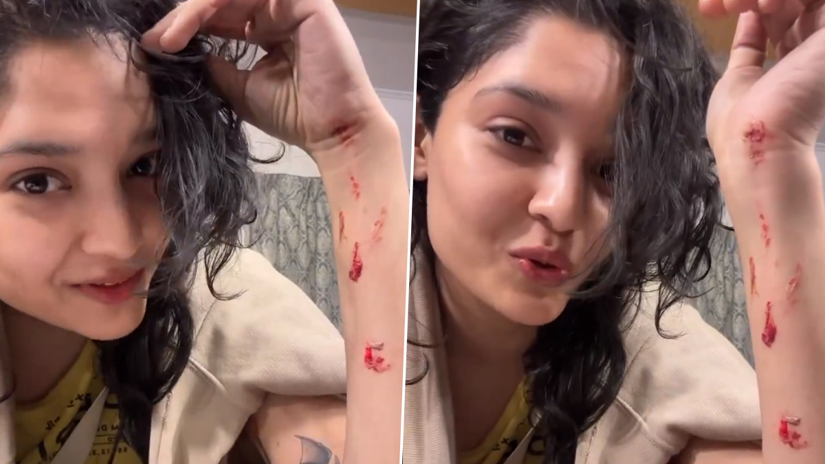 Rithika Singh Injured On The Sets